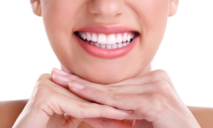 teeth whitening guide and at home kit